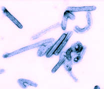 vRussell Regnery_marburgvirus
